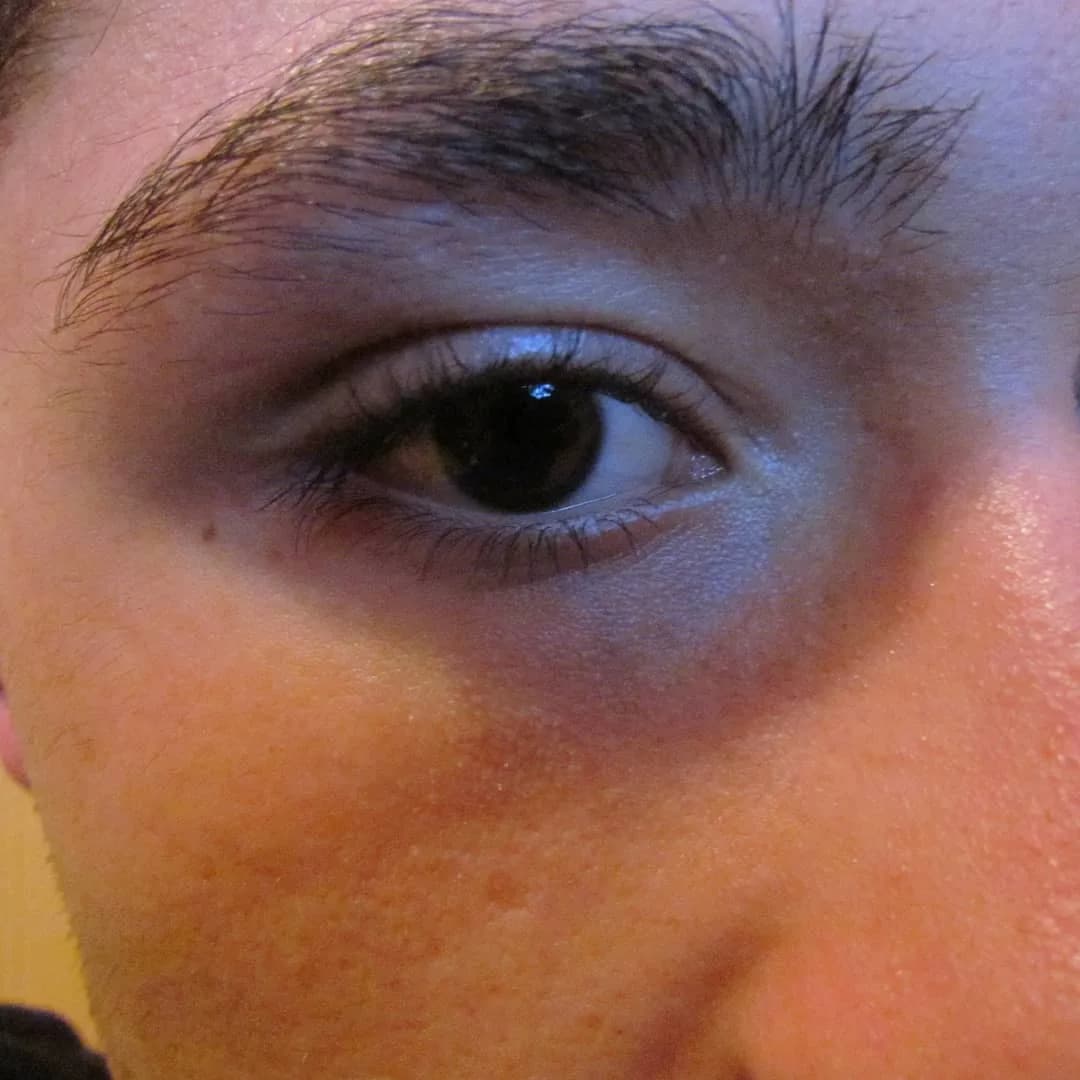 Nico's dilated pupils